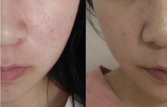 北京世熙整形医院怎么样?