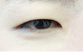上海洁铭整形医院怎么样?