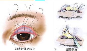 苏州美贝尔整形医院怎么样?