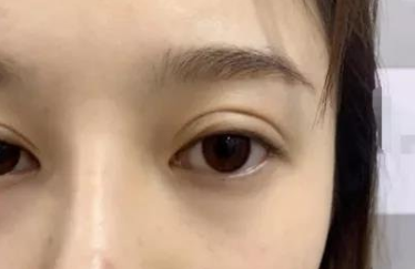 上海九院肖开颜技术怎么样?案例|点评