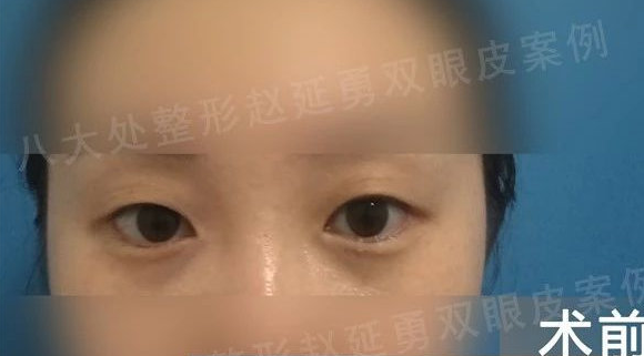 北京八大处赵延勇技术怎么样?案例|点评