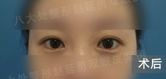 北京八大处赵延勇技术怎么样?案例|点评