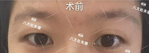 北京八大处朱珊技术怎么样?案例|点评
