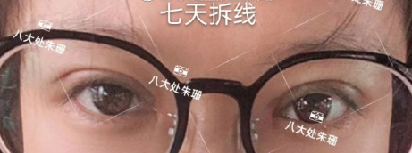 北京八大处朱珊技术怎么样?案例|点评