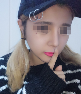成都素美卢元刚做鼻子怎么样,有没有失败案例