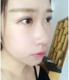 北京八大处王欢肋骨鼻做的怎么样？