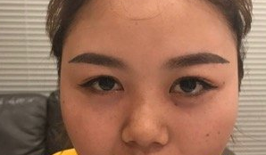 上海九院隆鼻怎么样?技术、价格、口碑如何?