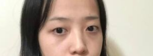 八大处整形科割双眼皮怎么样?哪个医生做的好