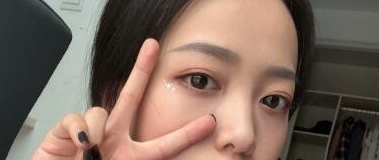 八大处整形科割双眼皮怎么样?哪个医生做的好