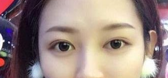 沈阳杏林美容整形医院做双眼皮怎么样?