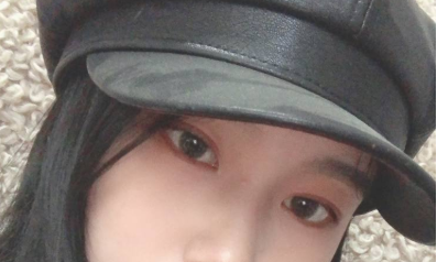 上海李斌医疗美容李斌做双眼皮怎么样?案例|点