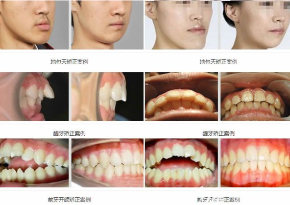 北京维乐口腔医院周铭医生怎么样?案例|点评