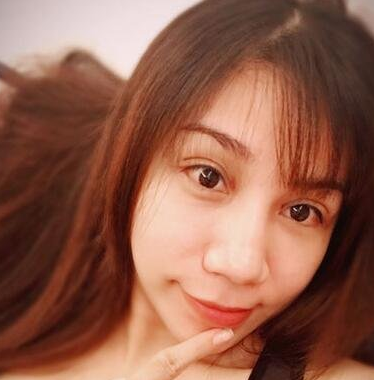 青岛伊美尔刘长发做双眼皮怎么样?案例|点评