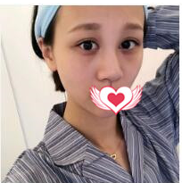 珂琳雅医疗美容整形医院王陈医生怎么样？案例