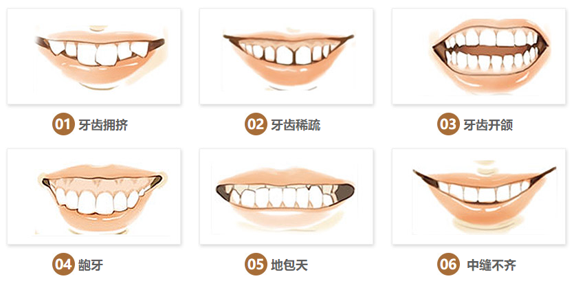 北京中诺口腔孟岩矫正牙齿怎么样?案例|点评