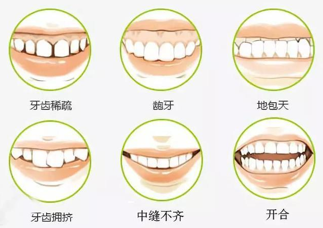 靖江北极星口腔医院张海瀚做牙齿整形怎么样?