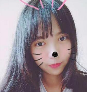 西安爱丁整形美容医院丁合军做双眼皮怎么样?
