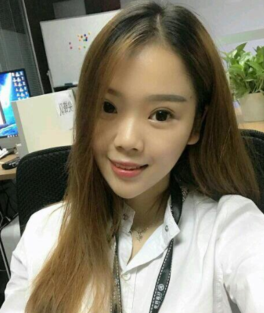 北京艾玛整形医院李方奇做双眼皮怎么样?
