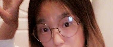 潍坊医学院整形外科医院哪个医生做双眼皮好?