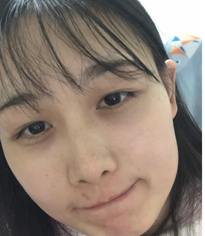 上海九院去眼袋哪个医生好?