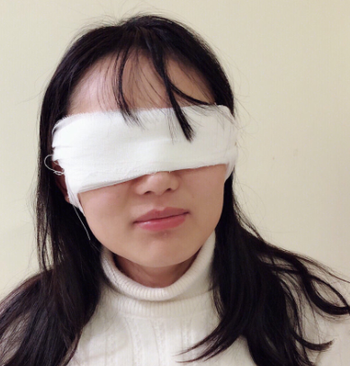 上海九院去眼袋哪个医生好?