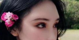 沈阳名流美容医院王旭做双眼皮怎么样?