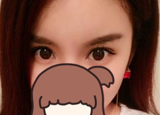 佳木斯美白美容医院做双眼皮手术怎么样?