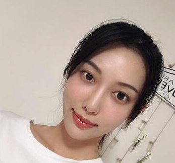 美壹典医疗美容鲁树荣医生做脂肪填充怎么样?