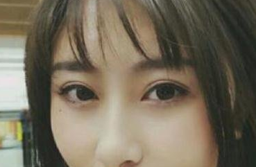 昆山百达丽整形美容医院双眼皮手术怎么样?