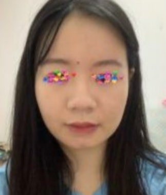 先调鼻子还是先调脸型比较好呢?