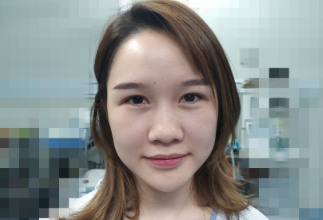 武汉韩辰医院刘明飞做隆鼻手术怎么样?