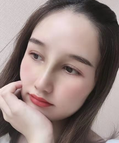 武汉韩辰医院刘明飞做隆鼻手术怎么样?