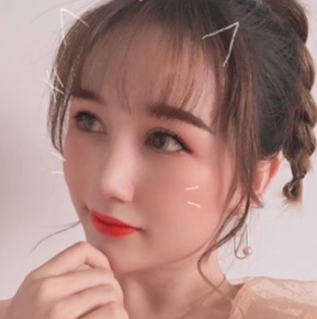 武汉韩辰医院吴辉医生做隆鼻手术怎么样?