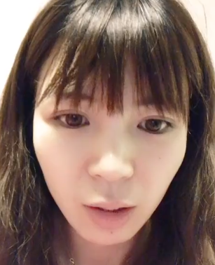 北京八大处顾云鹏做双眼皮手术怎么样?