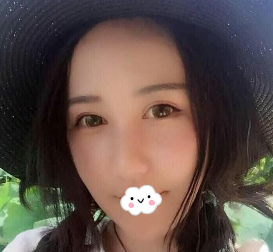 昆明美伊莱医疗美容门诊部周诚做隆鼻怎么样?
