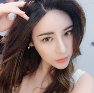 广州曙光医院耳软骨复合隆鼻案例分享!