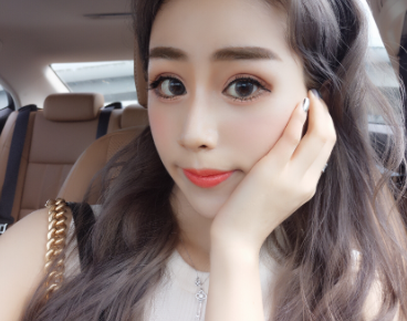 无锡施尔美医院切开双眼皮案例分享!