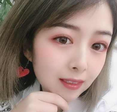 沈阳杏林整形医院冯光任做双眼皮手术怎么样?