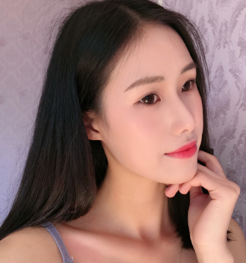 温州和平整形医院医生梁赞姜隆鼻案例分享!