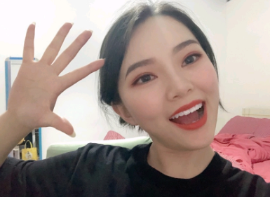 丰泽黄惠铭医疗美容诊所切开双眼皮案例分享!