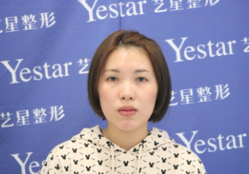 宁波艺星医院肋软骨隆鼻案例分享!