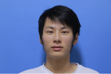 杭州时光医美医生陈小平下颌角整形案例分享!