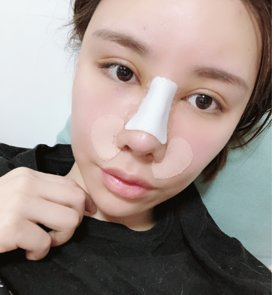 俊泰丽格医疗美容隆鼻怎么样?