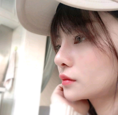 银川维多利亚医疗美容医院医生苏月鼻部手术案例