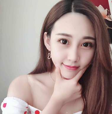 四川美莱切开双眼皮术后八十天案例果分享!