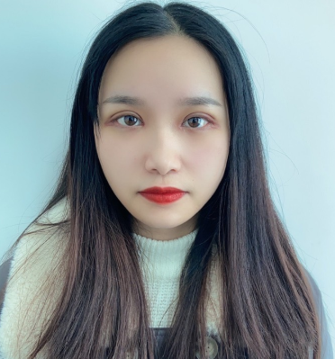 长沙爱美者双眼皮术后果案例分享!