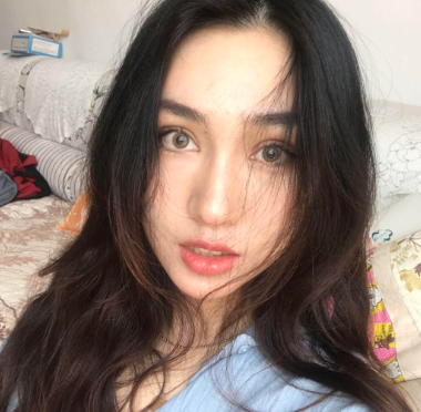 沈阳杏林整形外科医院切开双眼皮果怎么样?