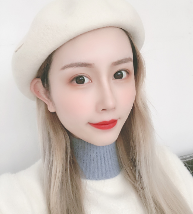 医疗美容医生刘歆自体脂肪全脸填充案