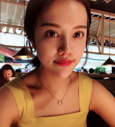 新疆乌鲁木齐华美整形美容医院鼻部手术案例分享