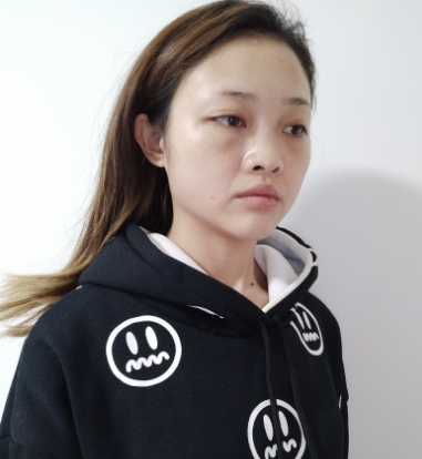 丰泽黄惠铭医疗美容诊所隆鼻案例分享!